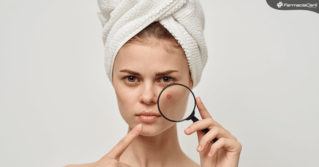 Macchie post acne: come eliminarle con i giusti prodotti e rimedi